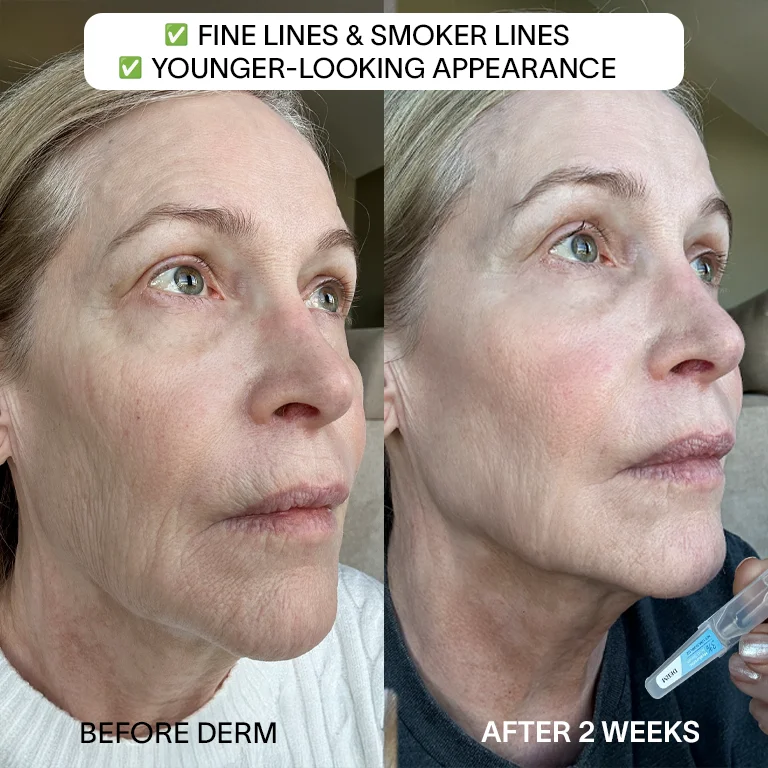 Derm™ 3% Hyaluronic Acid - Cyber Monday Sale - Image 3